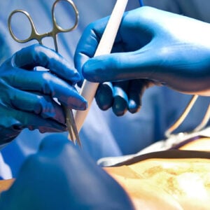 A Complete Guide to Ethylene Oxide Sterilization: Principles, Applications, Regulations, and Alternatives