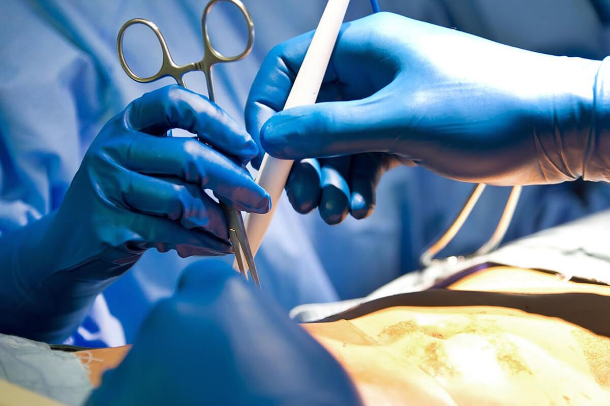 A Complete Guide to Ethylene Oxide Sterilization: Principles, Applications, Regulations, and Alternatives
